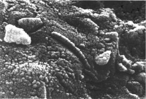 Martian microbes